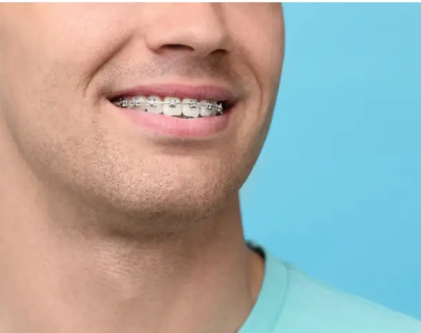 man wearing braces