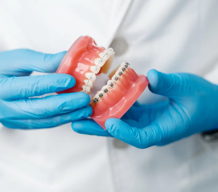 dentist holding model of teeth with braces